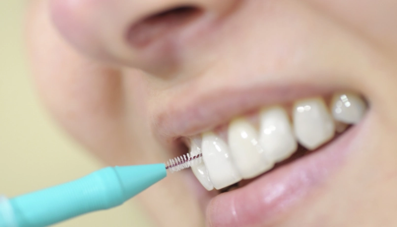 牙間刷使用技巧 牙間刷使用技巧