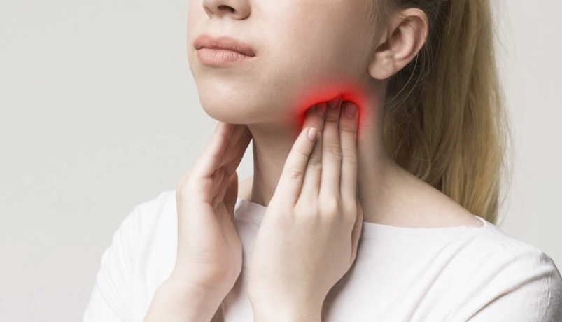 淋巴結腫大 淋巴結腫大