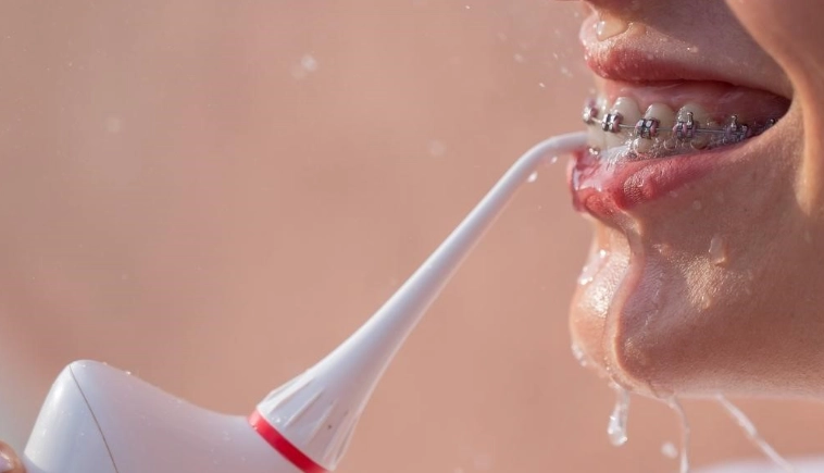 沖牙機不適合什麼人 沖牙機不適合什麼人