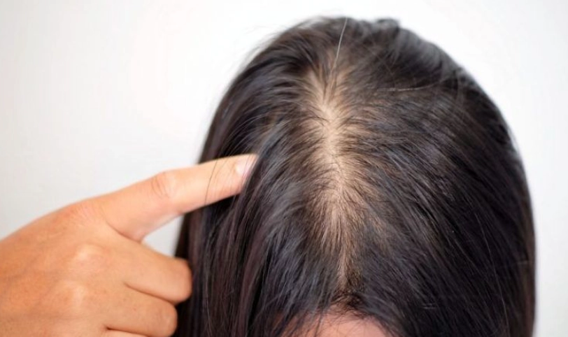 頭髮變細吃什麼 頭髮變細吃什麼