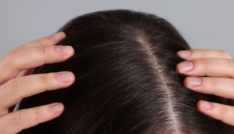 頭髮變細改善全攻略：從原因到對策，找回豐盈秀髮的實用指南