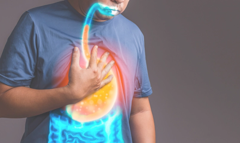 胃食道逆流可以吃人蔘嗎？中醫師教你正確進補與避開禁忌