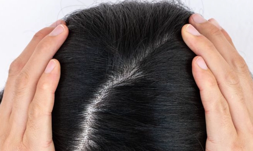 掉髮原因 掉髮原因