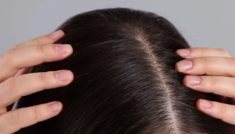 頭髮變細原因全解析：從日常習慣到根本對策