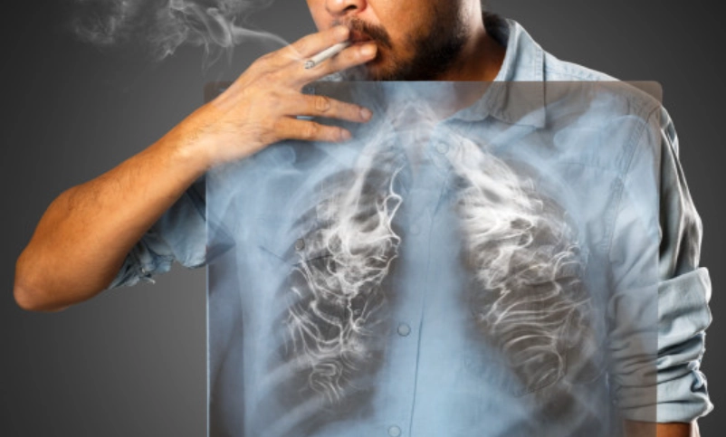 肺部排毒 肺部排毒