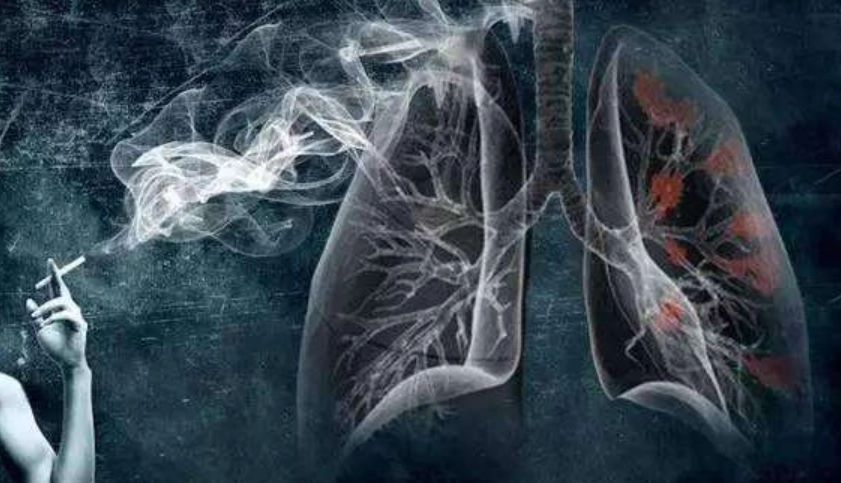 戒烟后清肺全攻略：加速肺部修复的10个有效方法
