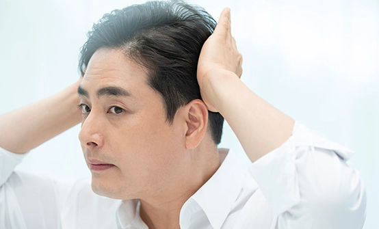 雄性禿