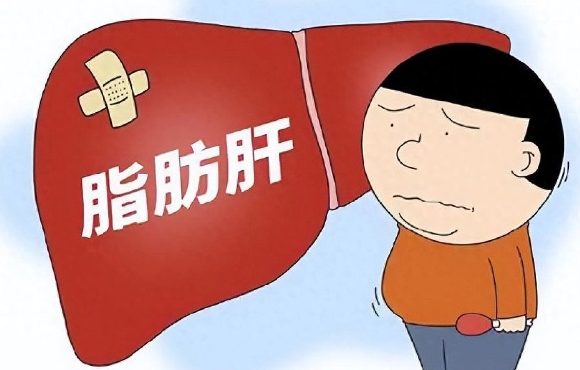 脂肪肝心血管疾病 脂肪肝心血管疾病