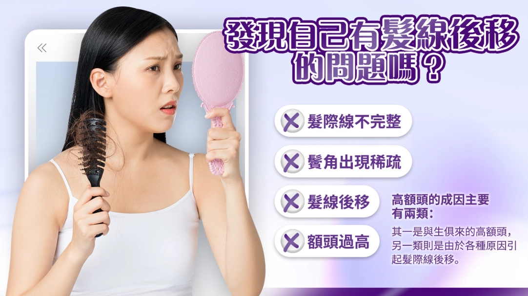 髮際線低髮型 髮際線低髮型