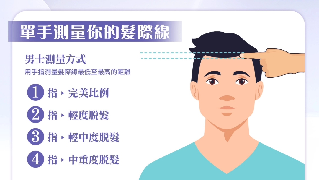 髮際線低怎麼辦？髮型、修容與醫美選項的實用解法