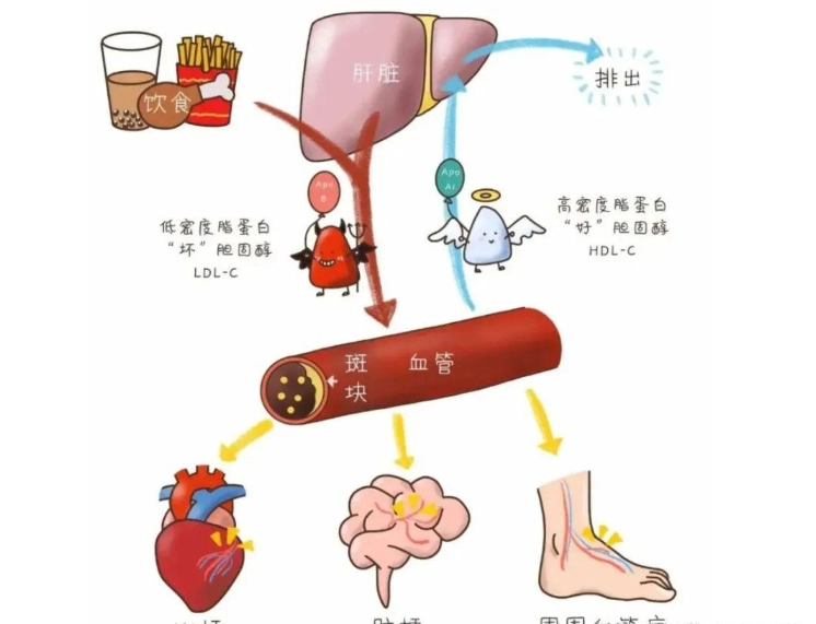 降膽固醇運動 降膽固醇運動