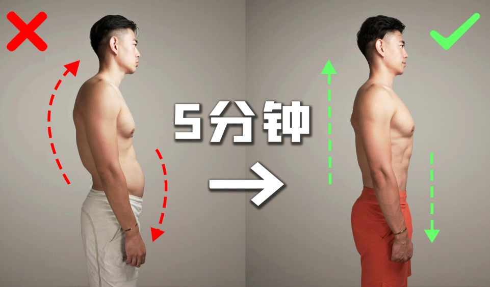 圓肩駝背矯正 圓肩駝背矯正