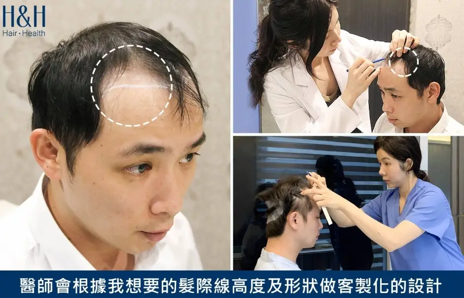額頭短 額頭短