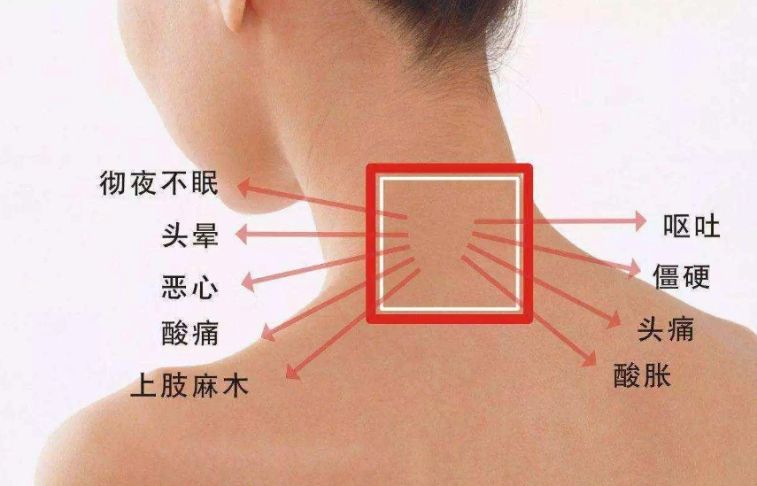 頸動脈竇 頸動脈竇
