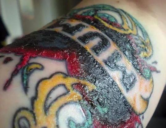 刺青後喝酒影響