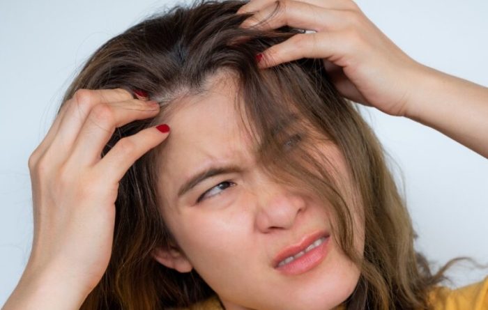 止癢噴霧推薦 止癢噴霧推薦