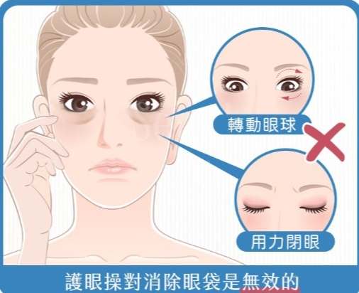 臉部運動眼袋