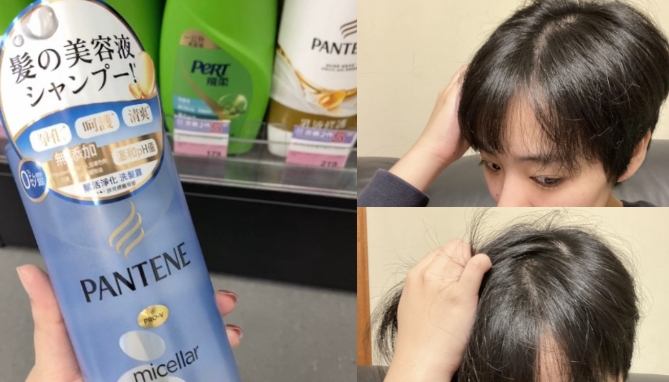 乾性頭皮頭皮屑處理