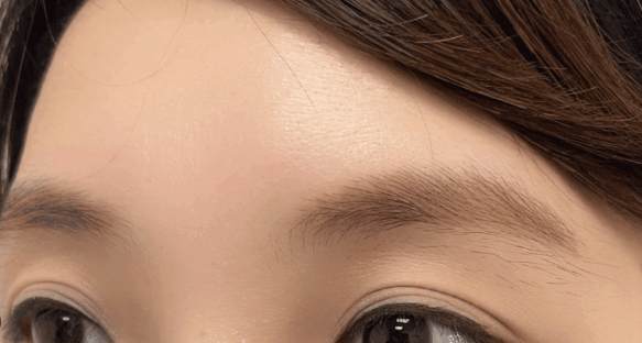 霧眉去除風險 霧眉去除風險