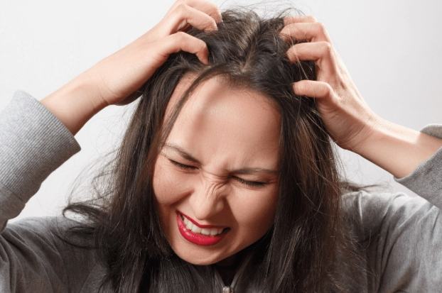 頭皮癢原因 頭皮癢原因