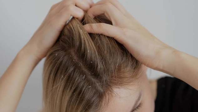 止癢噴霧推薦 止癢噴霧推薦