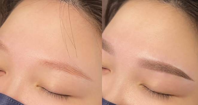 霧眉去除風險 霧眉去除風險