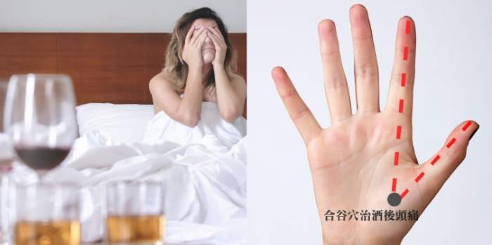 宿醉症狀