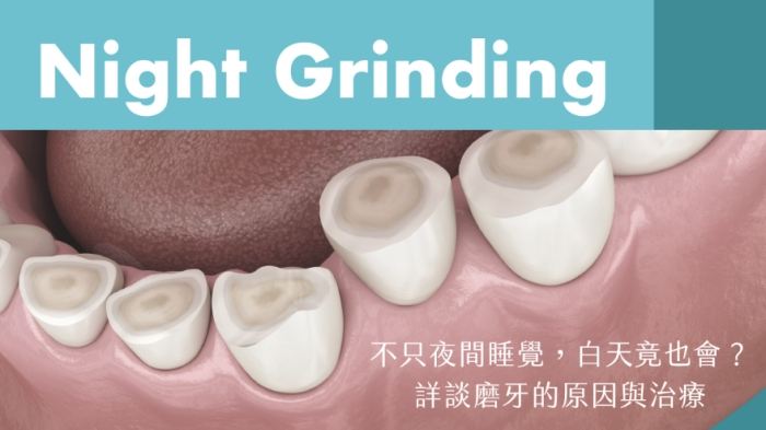 夜間磨牙中醫 夜間磨牙中醫
