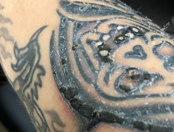 紋身恢復期護理