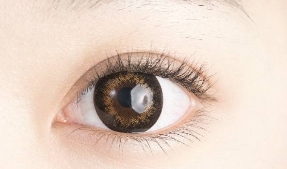 雙眼皮手術恢復 雙眼皮手術恢復