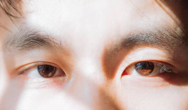 眼睛不對稱治療