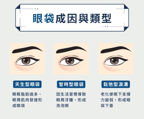 眼袋形成原因