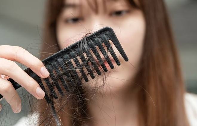 女性掉髮飲食