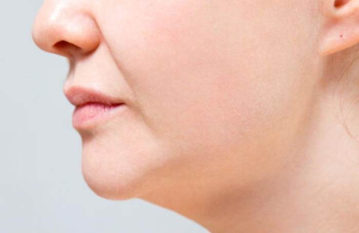 下顎線模糊成因 下顎線模糊成因