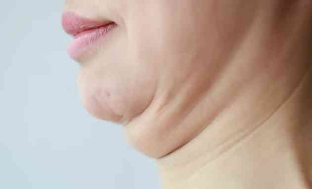 下顎線模糊成因 下顎線模糊成因