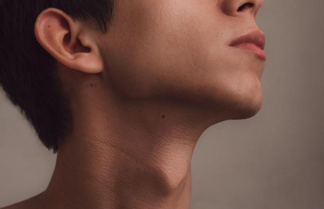 下顎線模糊成因 下顎線模糊成因