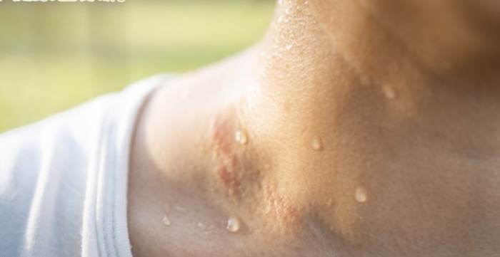 戒菸盜汗怎麼辦