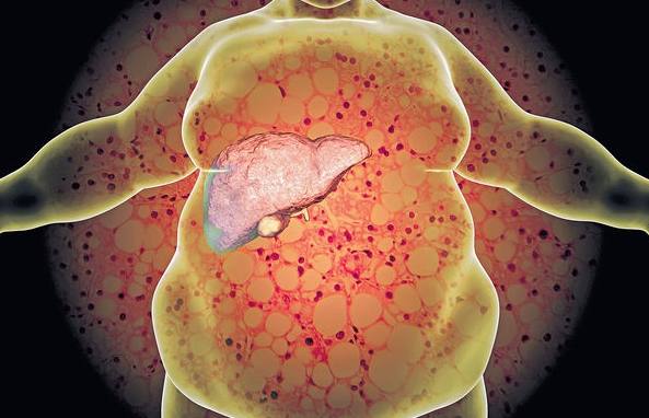 脂肪肝自然療法