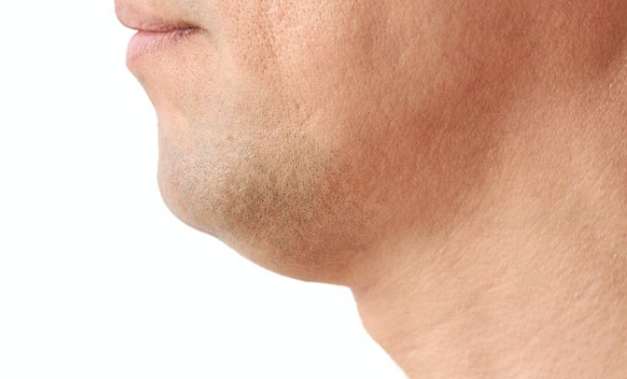 臉部輪廓不明顯 臉部輪廓不明顯