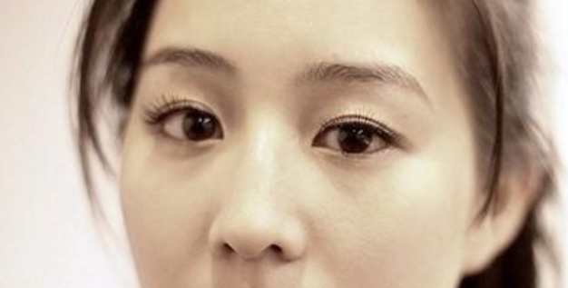 眼睛大小眼治療 眼睛大小眼治療