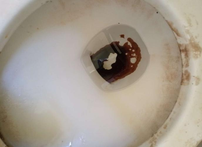 馬桶邊緣尿垢清除 馬桶邊緣尿垢清除