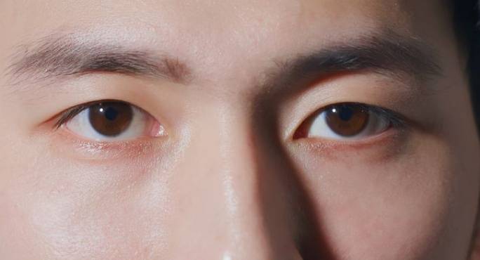 眼睛不對稱原因 眼睛不對稱原因