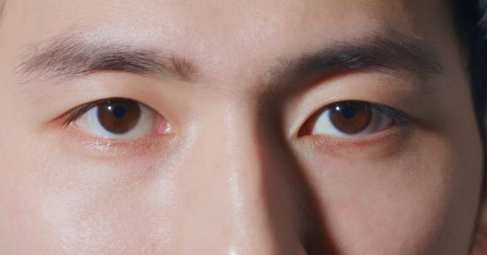 眼睛不對稱原因 眼睛不對稱原因