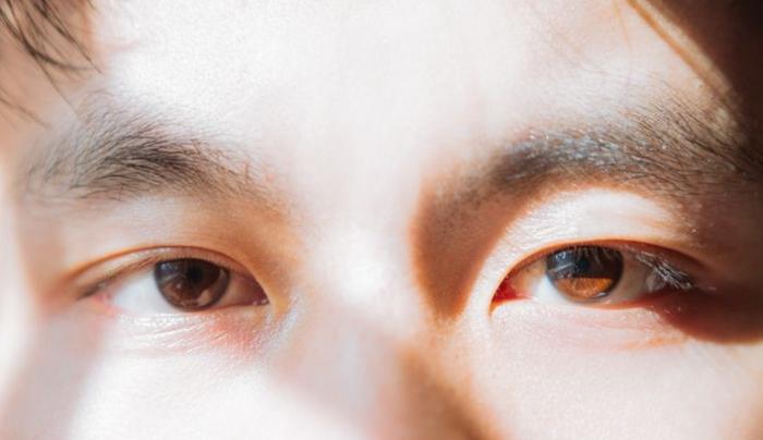 眼睛大小眼治療 眼睛大小眼治療