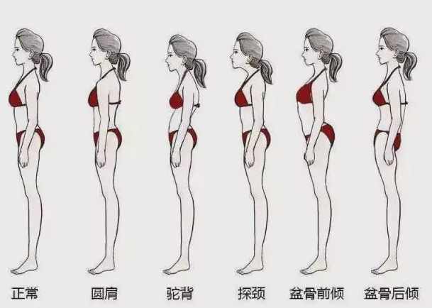 体态矫正方法 体态矫正方法
