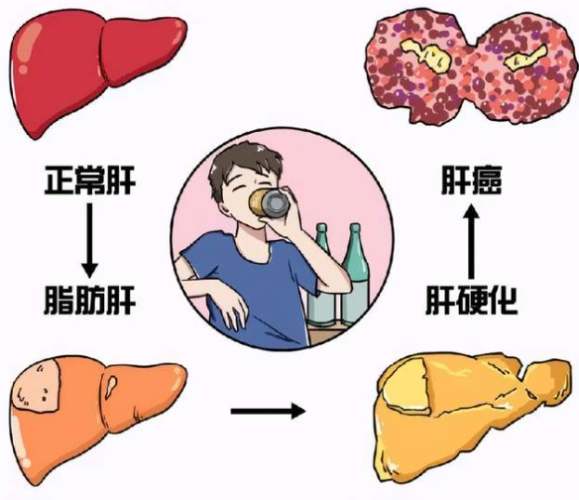 中醫食療脂肪肝