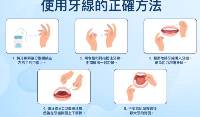 牙線技巧教學