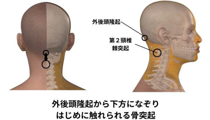 淋巴結腫大治療