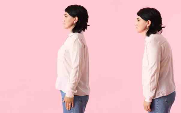 駝背危害 駝背危害