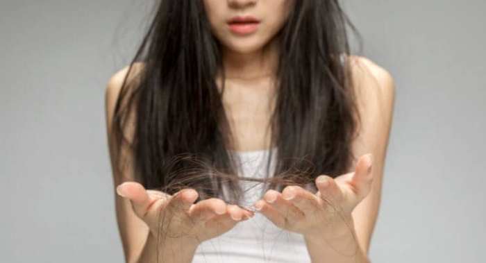 掉髮治療 掉髮治療